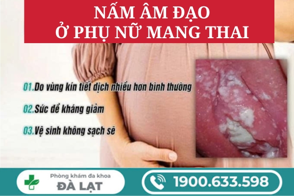 Bệnh Nấm Âm Đạo Ở Phụ Nữ Mang Thai 